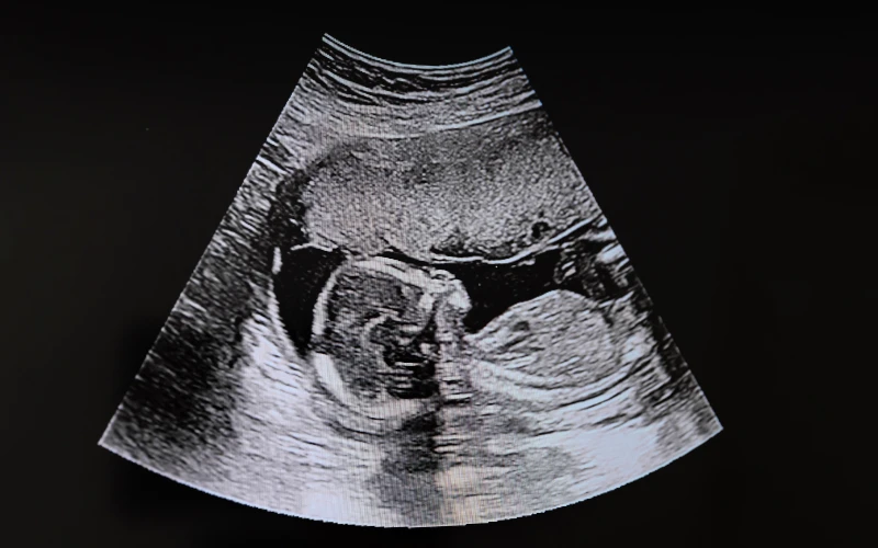 Obispos de EE. UU. Respaldo a Nuevas Restricciones en Ayuda Exterior para Aborto y Género