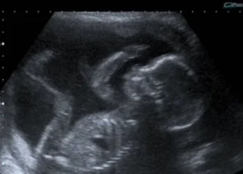 La Corte Suprema de Estados Unidos suspende temporalmente las restricciones a la píldora abortiva mifepristona