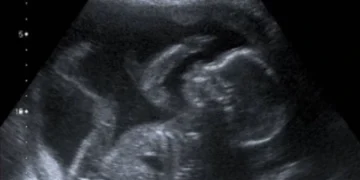 La Corte Suprema de Estados Unidos suspende temporalmente las restricciones a la píldora abortiva mifepristona
